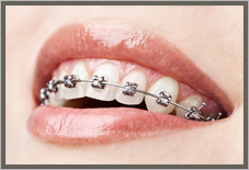 What is Orthodontics?