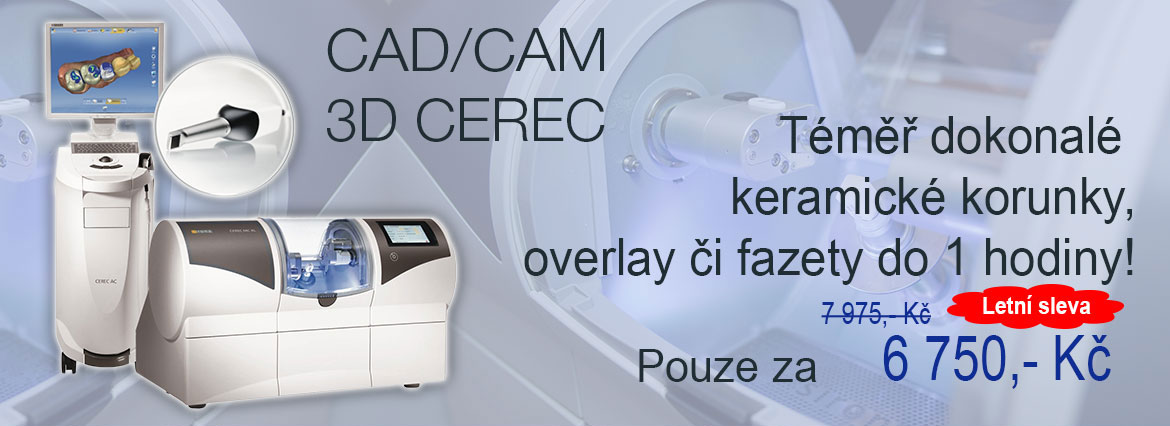 Korunky a fazety technologie CAD/CAM 3D CEREC