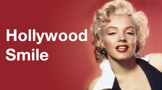 Hollywood Smile