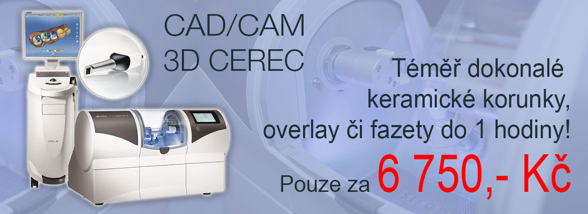 Korunky a fazety technologie CAD/CAM 3D CEREC